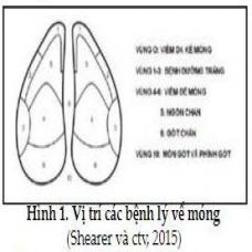 BỆNH CHÂN MÓNG TRÊN ĐÀN BÒ SỮA VÀ ỨNG DỤNG BIOTIN TRONG ĐIỀU TRỊ